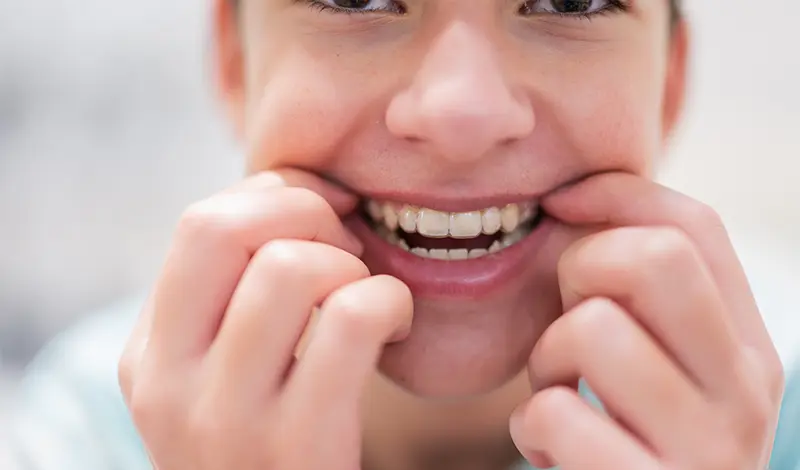 Straightening smiles with clear aligners