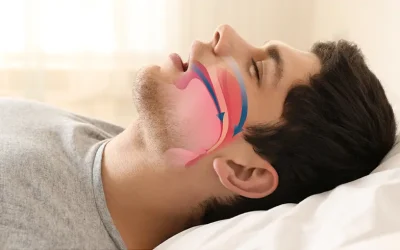 Why mouth breathing is detrimental to your health